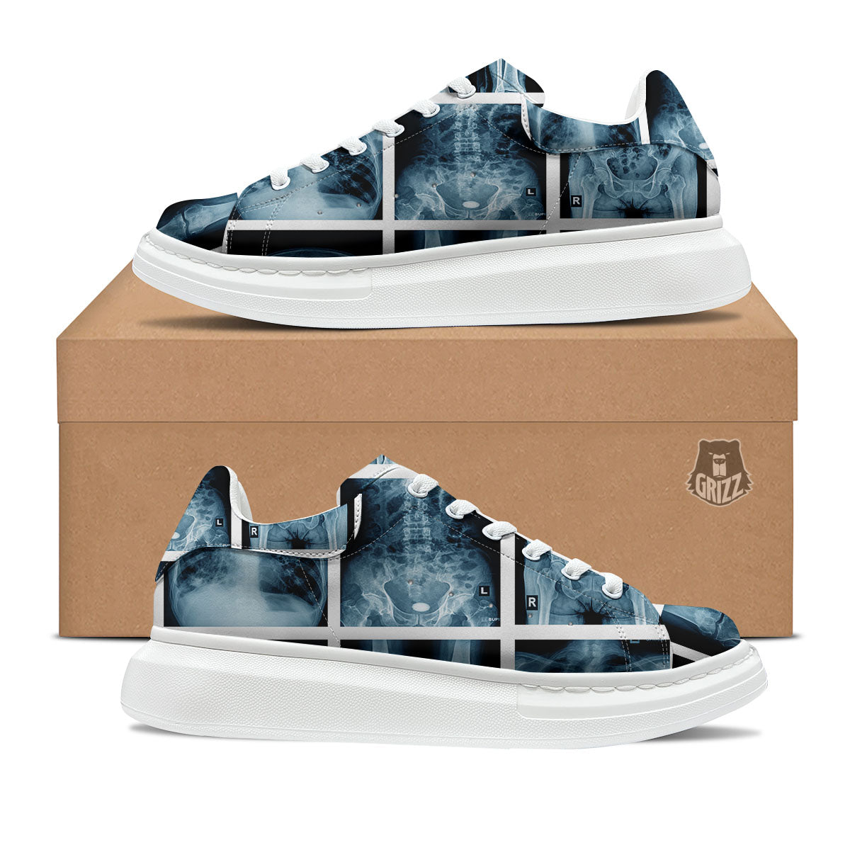 Radiology X-Ray Film Print Platform Shoes-grizzshop