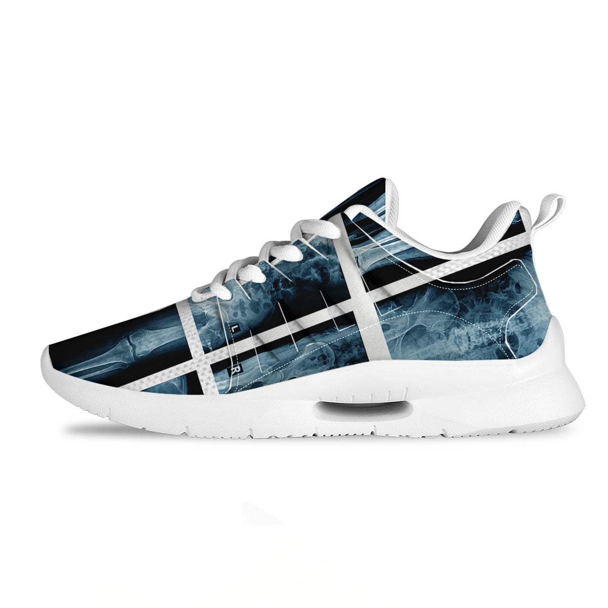 Radiology X-Ray Film Print Tennis Shoes-grizzshop