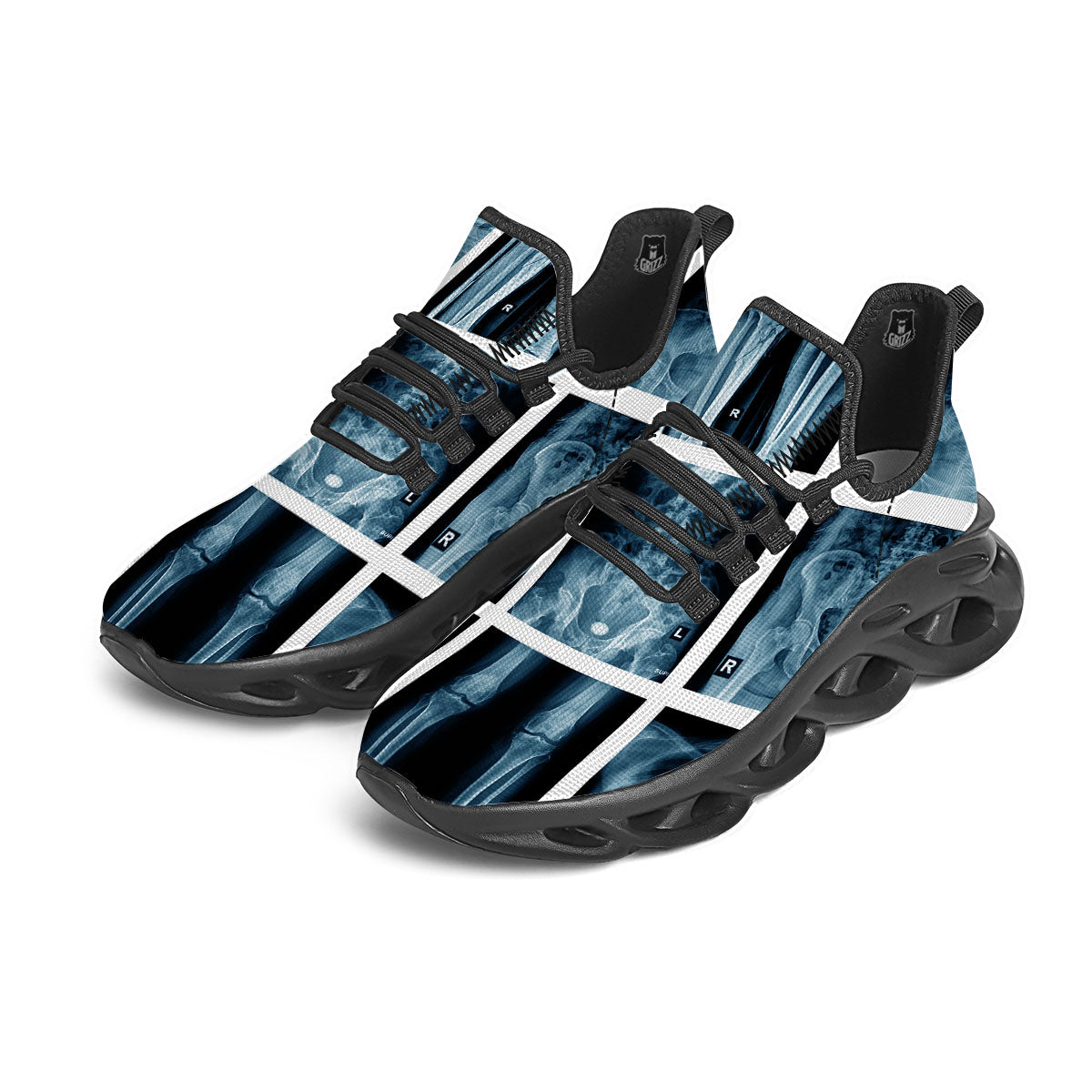 Radiology X-Ray Film Print Black Running Shoes-grizzshop