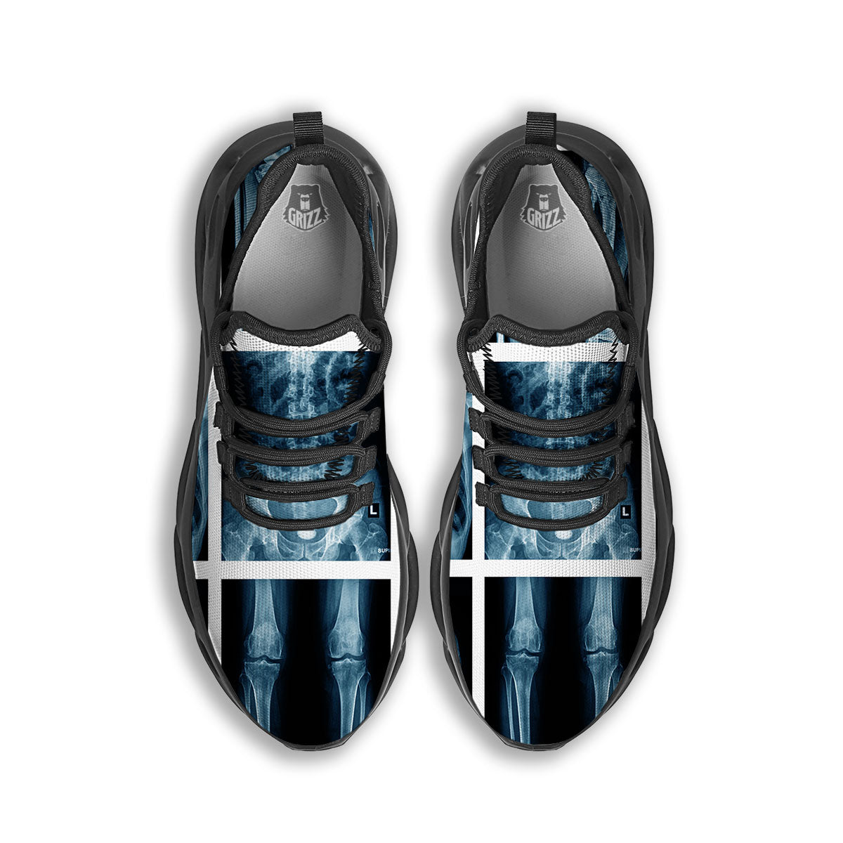 Radiology X-Ray Film Print Black Running Shoes-grizzshop