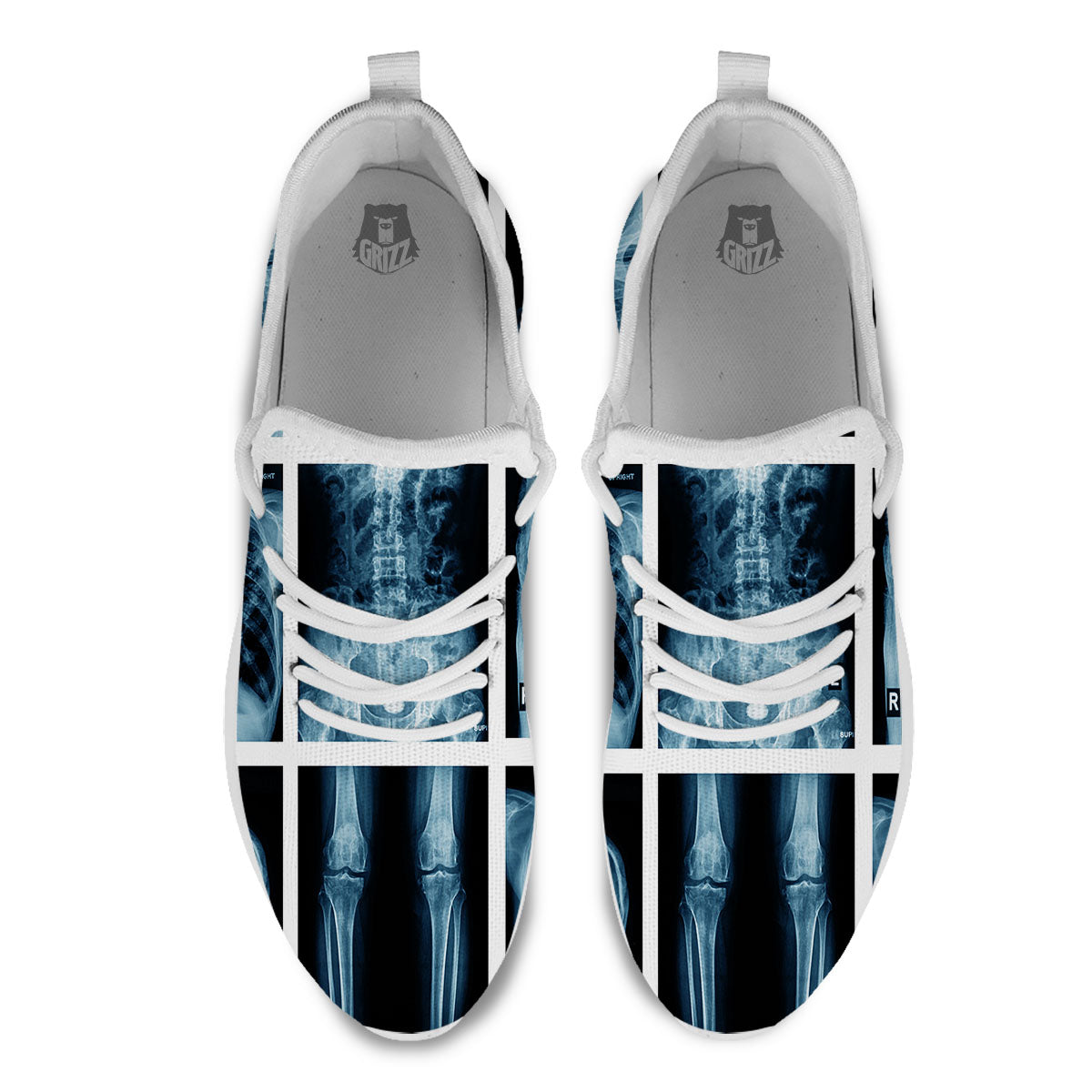 Radiology X-Ray Film Print White Athletic Shoes-grizzshop